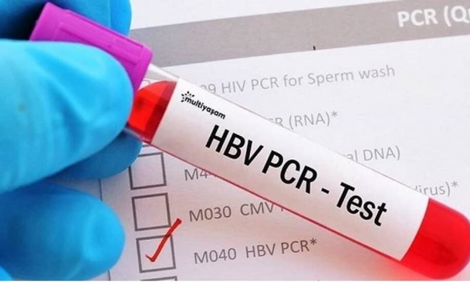 السعودية.. أسعار وأسماء المختبرات والمستشفيات الخاصة بفحص PCR في جدة ومكة والمدينة