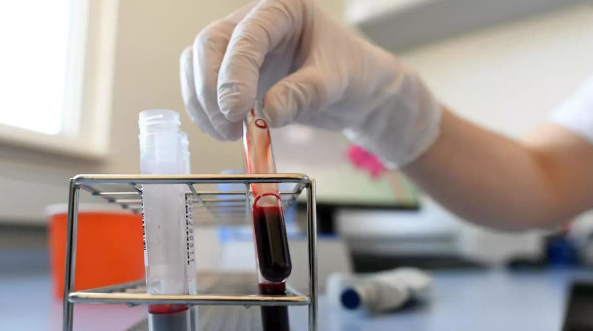 وزيرة الصحة تكشف عن إجراء أكثر من 90 ألف تحليل pcr للمشتبه في إصابتهم بكورونا