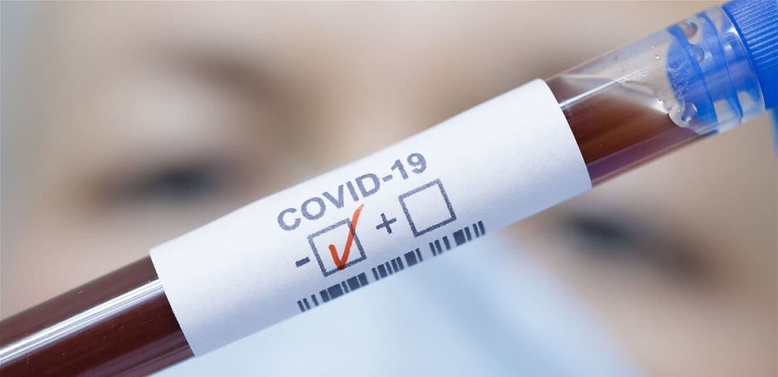 السعودية.. أحدث أسعار فحص PCR في المختبرات والمستشفيات الخاصة في أبها وضبا وجازان